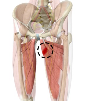 Hip Adductor Injuries