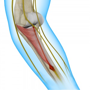 Radial Tunnel Syndrome