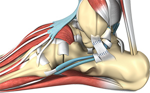 Ankle Sprain