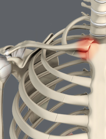 Sternoclavicular Joint (SC joint)