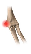Elbow Rehabilitation  Forms